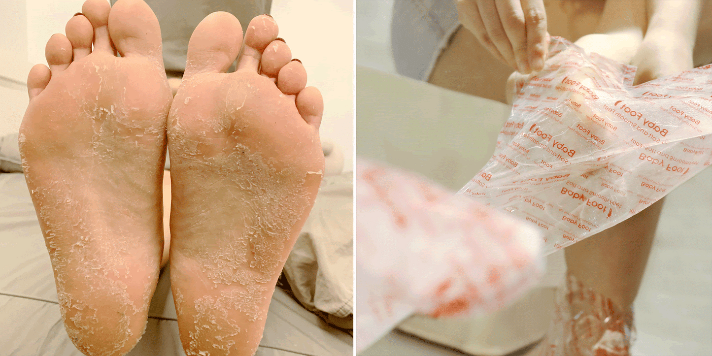 Original Foot Peel + White Plush Socks