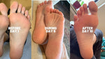 Blue Baby Foot Exfoliating Foot Peel pack showing two bottles of Baby Foot exfoliation foot peel for smooth, refreshed feet.